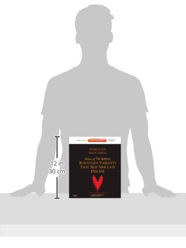 Atlas of Normal Roentgen Variants That May Simulate Disease: Expert Consult - Enhanced Online Features and Print