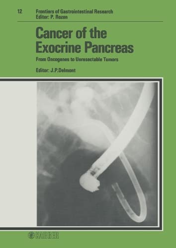 Cancer of the Exocrine Pancreas: From Oncogenes to Unresectable Tumors (Frontiers of Gastrointestinal Research)