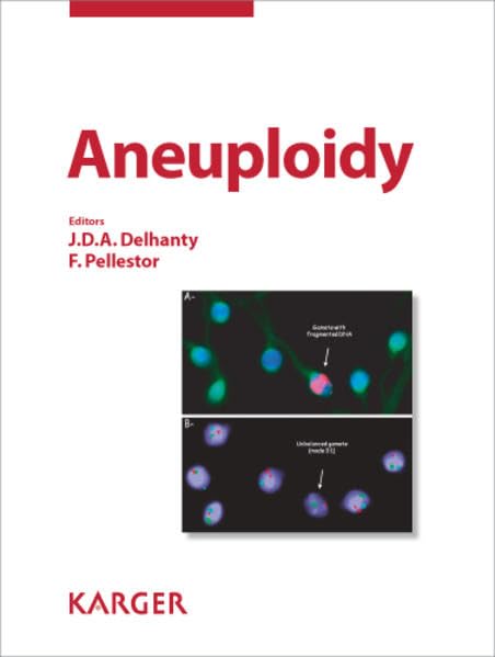 Aneuploidy: Cytogenetic and Genome Research 2011