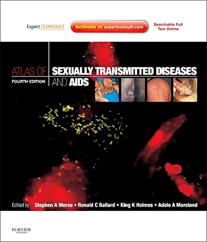 Atlas of Sexually Transmitted Diseases and AIDS: Expert Consult