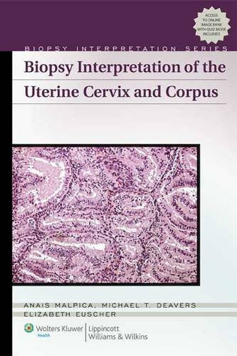 Biopsy Interpretation of the Uterine Cervix And Corpus