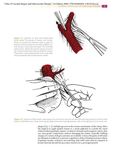 Atlas of Vascular Surgery and Endovascular Therapy: Anatomy and Technique