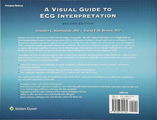 A Visual Guide to ECG Interpretation