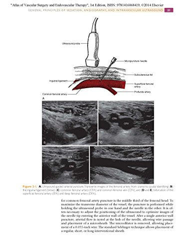 Atlas of Vascular Surgery and Endovascular Therapy: Anatomy and Technique