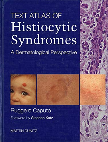 A Text Atlas of Histiocytic Syndromes