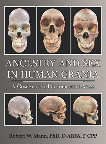 Ancestry And Sex In Human Crania: A Comparative Photographic Atlas