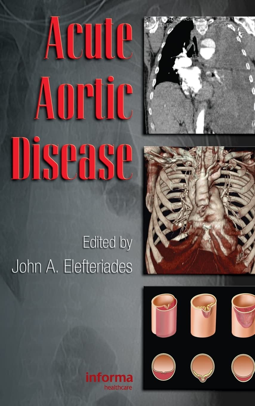 Acute Aortic Disease (Fundamental and Clinical Cardiology)