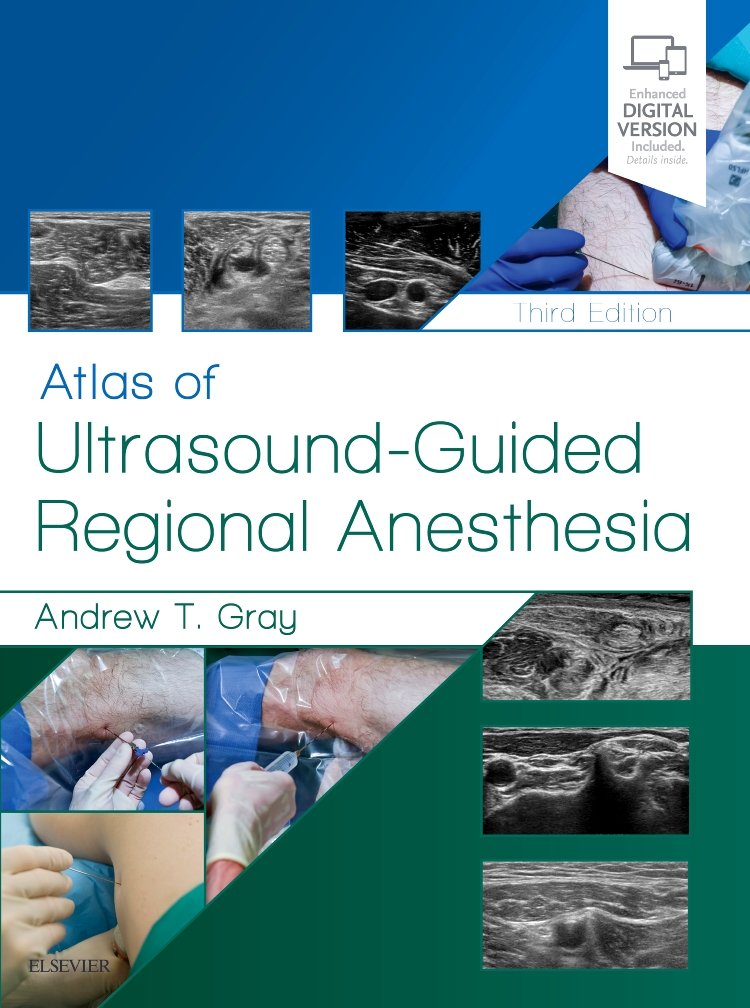 Atlas of Ultrasound-Guided Regional Anesthesia: Expert Consult - Online and Print