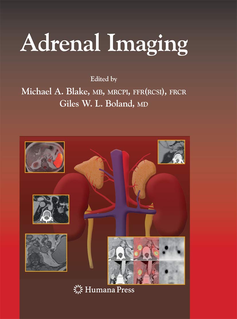 Adrenal Imaging (Contemporary Medical Imaging)