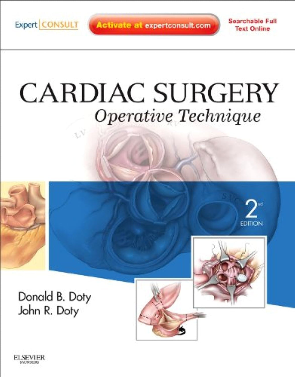 Cardiac Surgery: Operative Technique - Expert Consult: Online and Print