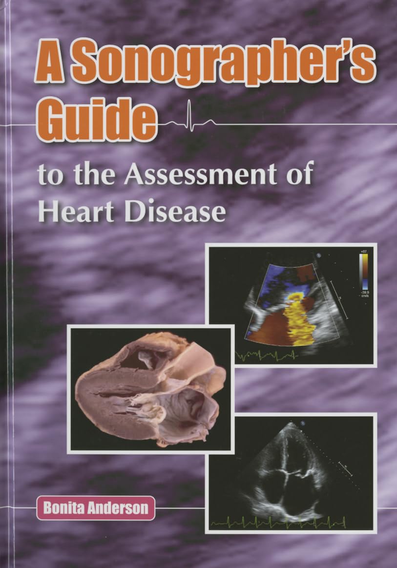 A Sonographer's Guide to the Assessment of Heart Disease