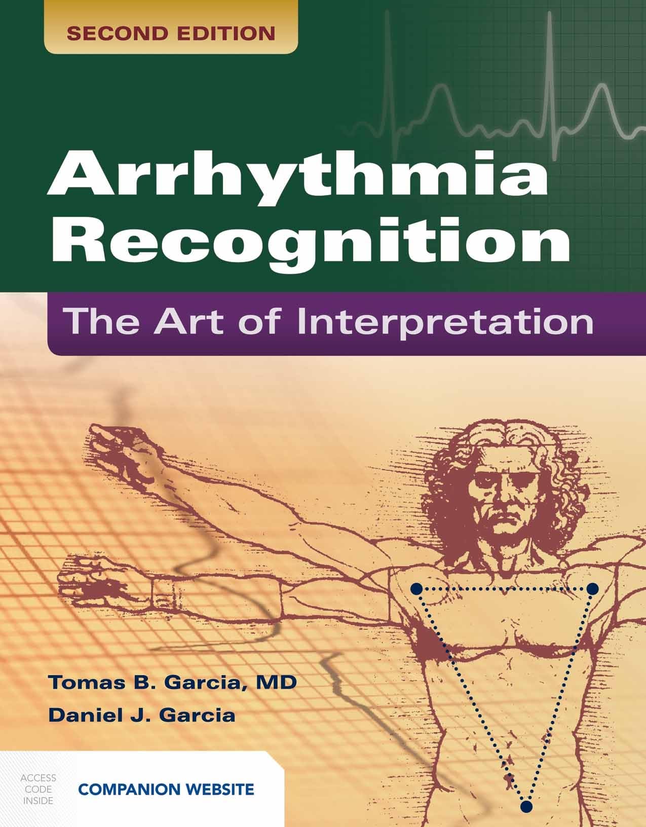 Arrhythmia Recognition: The Art of Interpretation: .