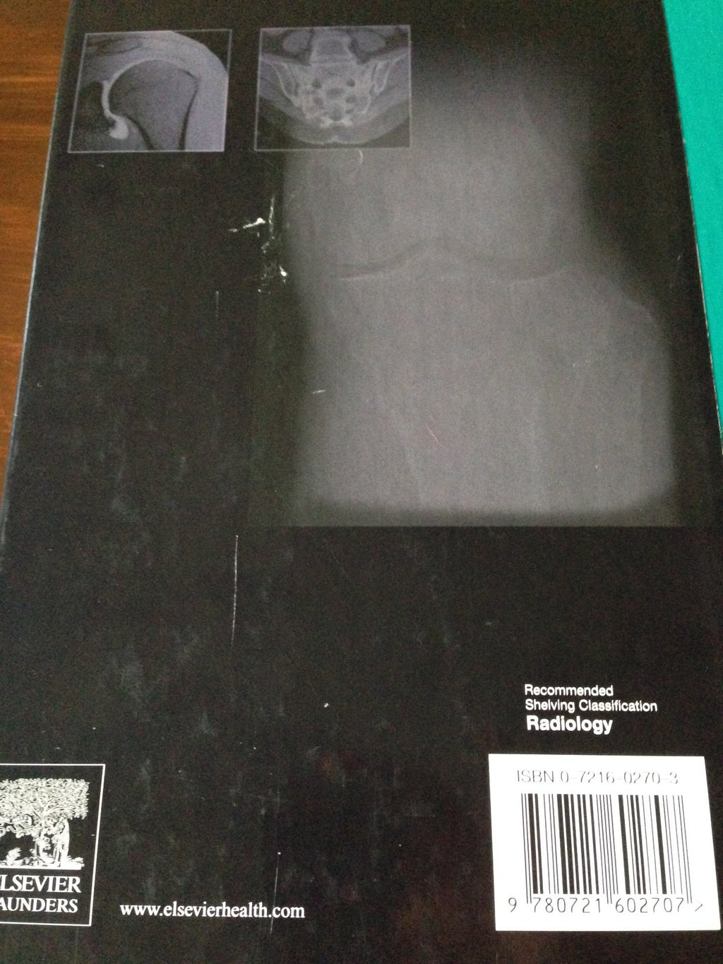 Bone and Joint Imaging