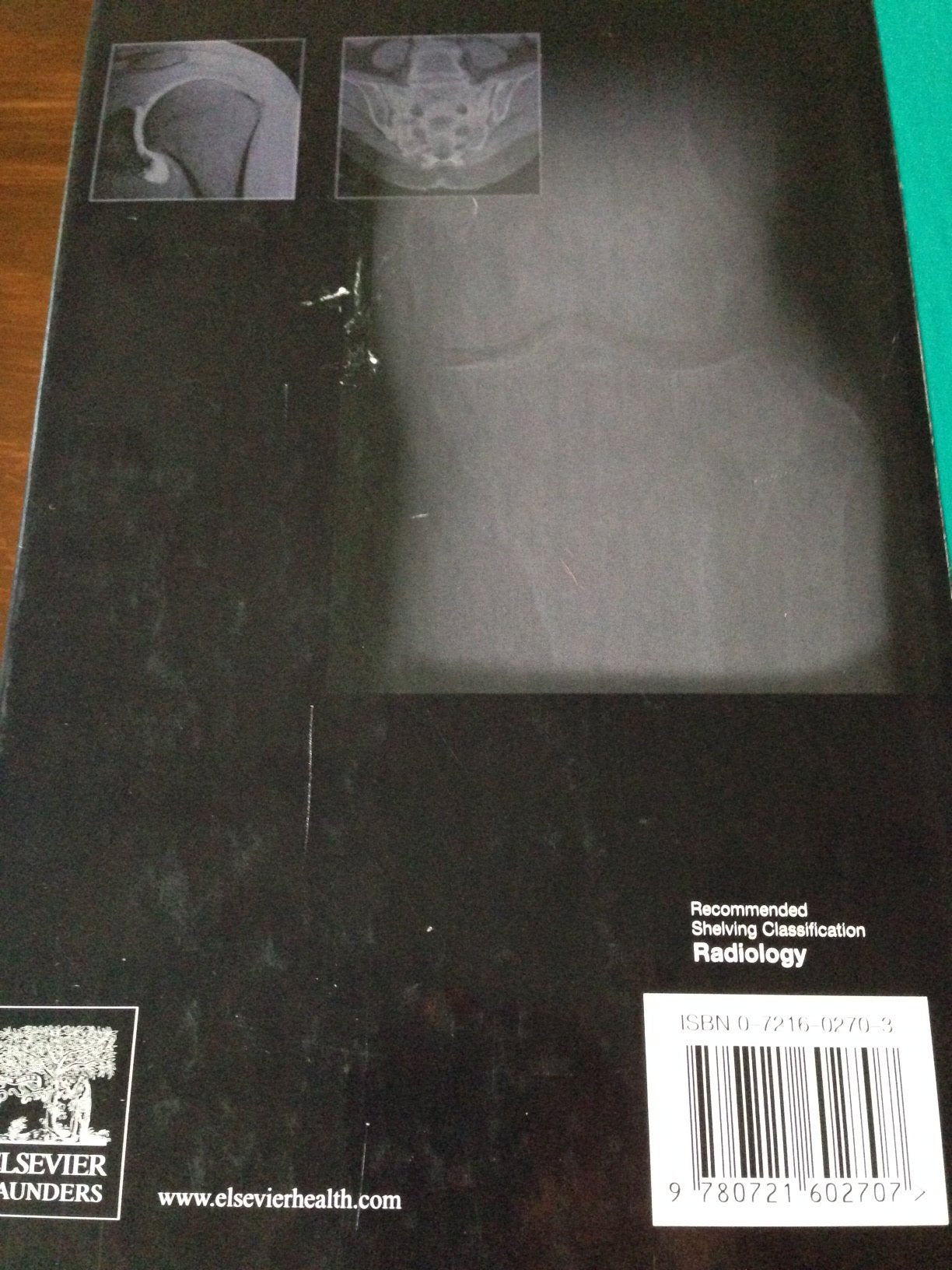 Bone and Joint Imaging