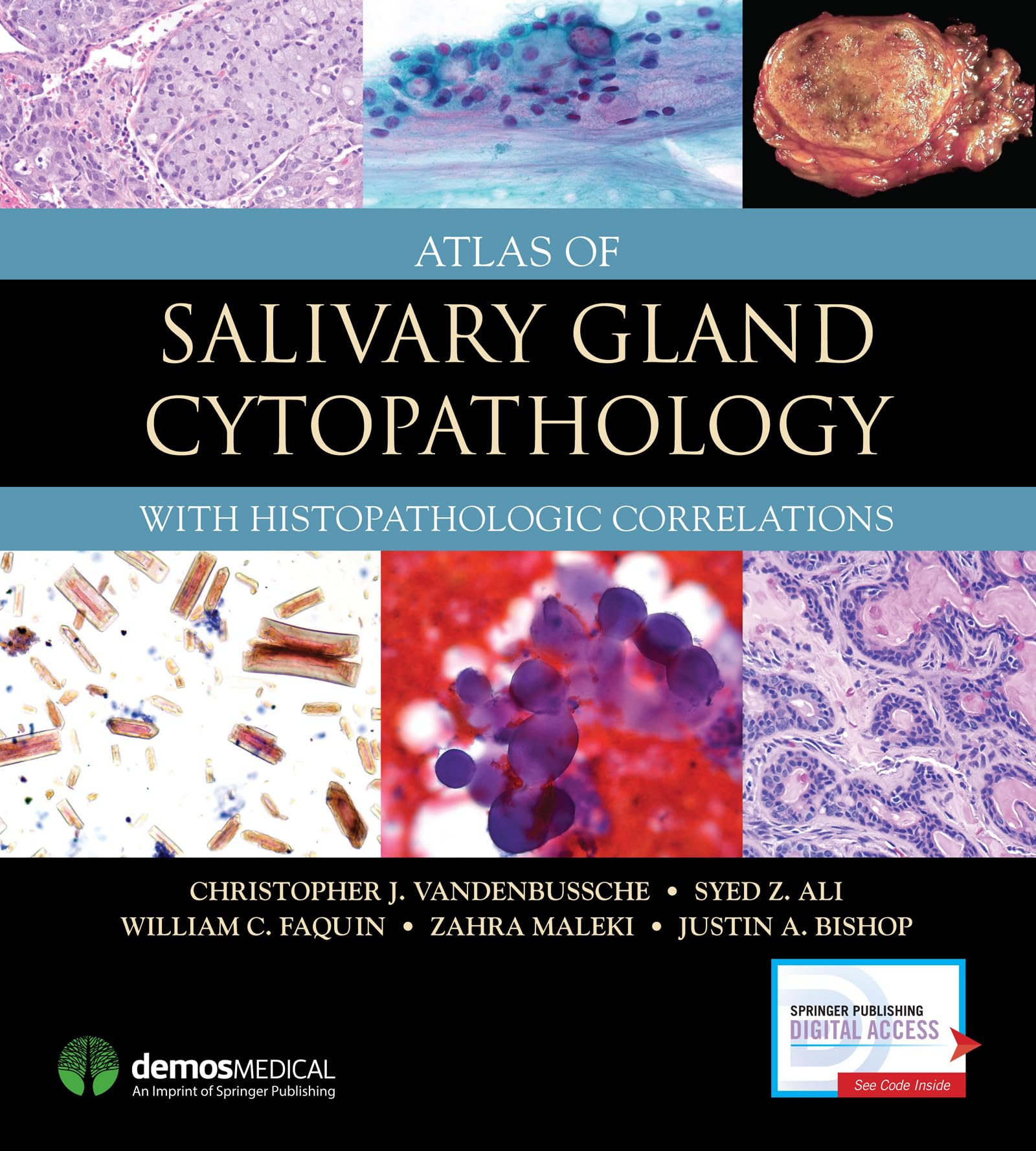 Atlas of Salivary Gland Cytopathology: with Histopathologic Correlations