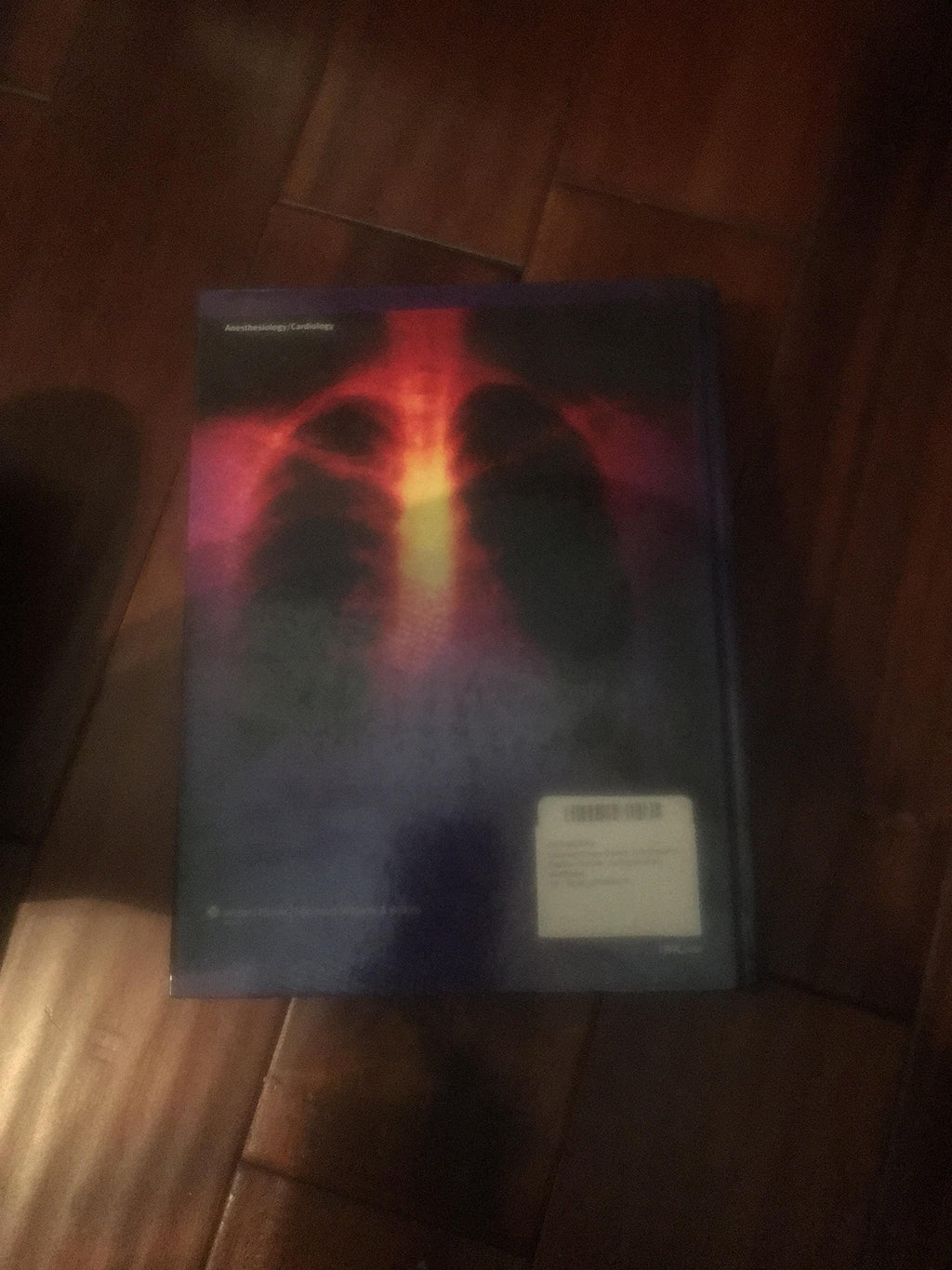 Cardiopulmonary Bypass: Principles And Practice