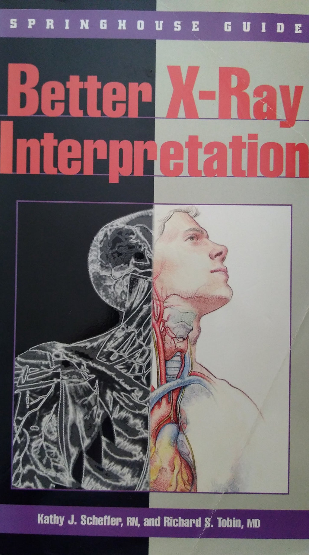 Better X-Ray Interpretation